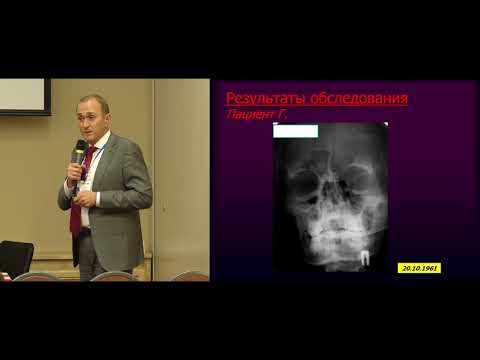 Видео: 09 Ратников В.А. Лучевая диагностика ЛОР патологии: мифы и реальность