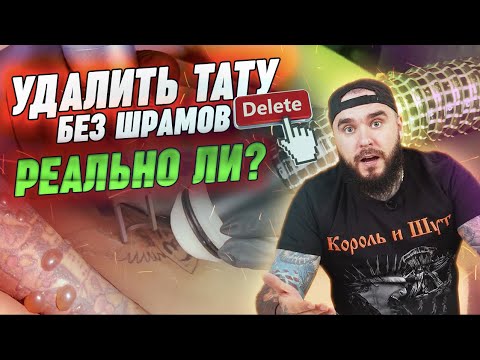 Видео: Не хочу ШРАМ после удаления тату! Как избежать повреждения кожи после лазерного удаления татуировки?