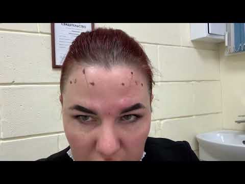 Видео: САМА СЕБЕ КОЛЮ БОТОКС!
