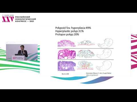 Видео: Эндоскопические и морфологические характеристики полипов желудка