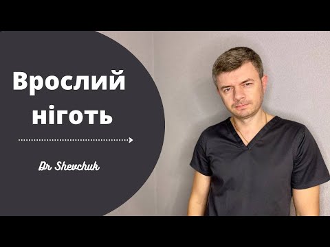 Видео: Врослий ніготь