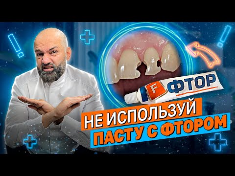 Видео: ФТОР УНИЧТОЖАЕТ ЗУБЫ.  НЕ используй эту зубную пасту! Зачем фтор добавляют в пасту?