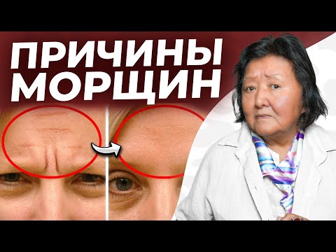 Видео: Эти 5 привычек создают морщины каждый день