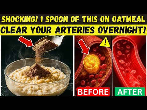 Видео: Добавьте ЭТОТ ингредиент в овсянку, чтобы очистить артерии за ночь! (Врачи никогда этого не говорят)