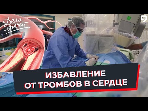 Видео: Программа "Дело врачей". Мерцательная аритмия. Транскатетерное закрытие ушка левого предсердия