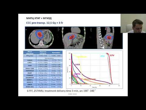 Видео: А2. Онкологическая целесообразность трансплантации печени при гепатоцеллюлярном раке