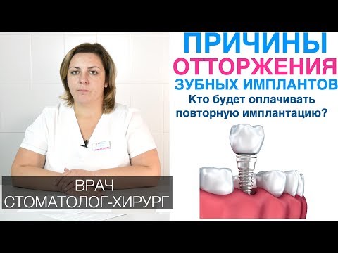 Видео: Причины отторжения зубных имплантов, симптомы, признаки. Приживляемость. Повторная имплантация.