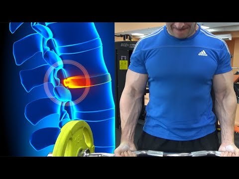 Видео: Как тренироваться при проблемах с позвоночником (грыжи и протрузии позвоночника)