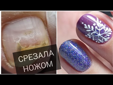 Видео: СРЕЗАЛА ноготь НОЖОМ