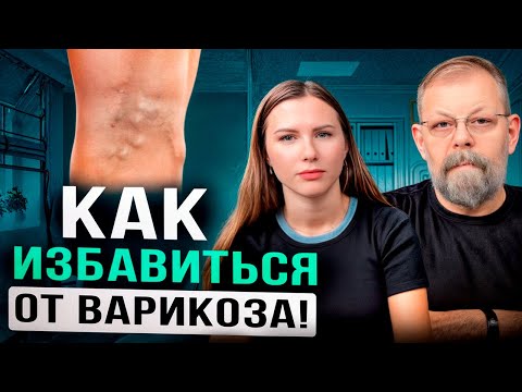 Видео: Варикозное расширение вен – Как вылечить варикоз?