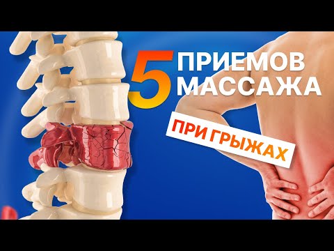 Видео: КАК ДЕЛАТЬ МАССАЖ ? При межпозвоночных грыжах.