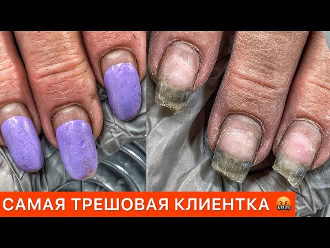 Видео: УНИЧТОЖИЛА НОГТИ ЗА 74 ДНЯ😱ГЕЛЕВЫЕ ТИПСЫ ВМЕСТО ВЕРХНИХ😎