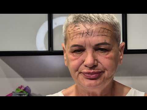 Видео: Токсин. 101 раз про осложнения. Принцип симметричности и поэтапности.