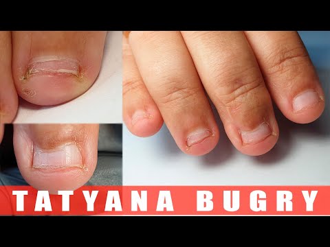 Видео: СЛОЖНЫЕ НОГТИ ГРЫЗУНЧИКА / НАРАЩИВАНИЕ НОГТЕЙ / ПРЕОБРАЖЕНИЕ / Татьяна Бугрий
