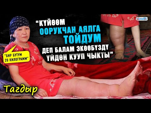 Видео: “Күйөөм оорукчан аялга тойдум деп балам экөөбүздү үйдөн кууп чыкты. Бир бутум 20 килограмм” | Тагдыр
