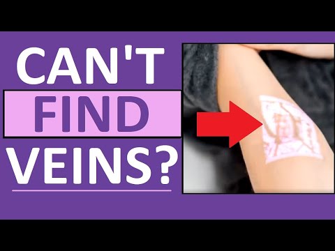 Видео: Труднодоступные вены: забор крови, внутривенные катетеры, венепункции – сестринское дело, флеботомия
