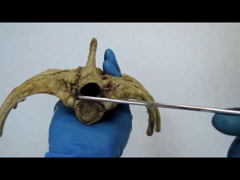 Видео: Видеозанятие 14 "Соединение костей осевого скелета"