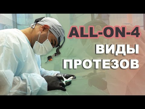 Видео: Виды протезов ALL ON 4. Какой выбрать? Бекоев Ацамаз