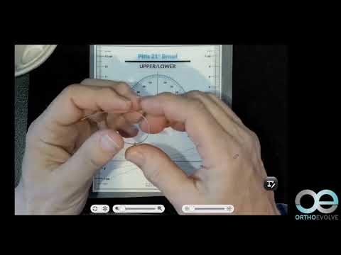 Видео: Формы дуг Pitt’s, рекомендации по применению