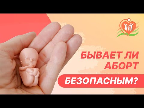Видео: 🔴  Бывает ли аборт безопасным?