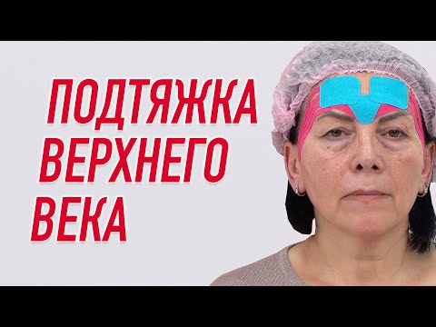 Видео: ✅ ПОДТЯЖКА ВЕРХНЕГО ВЕКА | Валентин Гайт | Учебный центр BBALANCE