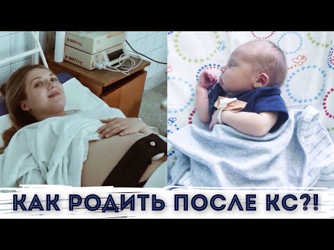 Видео: Естественные роды после кесарева сечения Естественные роды с рубцом на матке