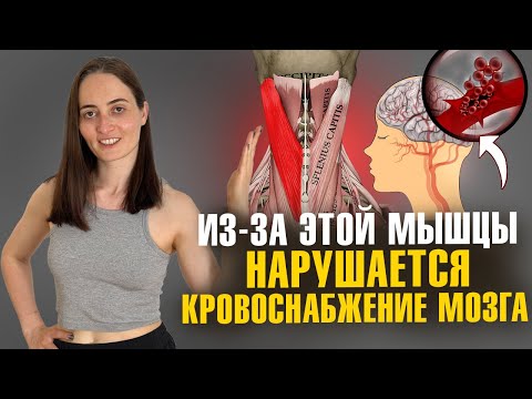 Видео: Нарушение кровоснабжения мозга, боли в шее, головные боли, риск инсульта и всё из-за ЭТОЙ мышцы