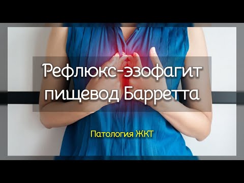 Видео: Рефлюкс эзофагит и пищевод Барретта | Патология