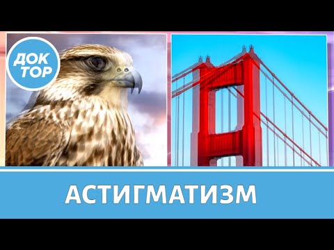 Видео: Что такое астигматизм, и как он проявляется?