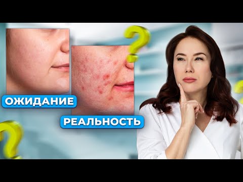 Видео: Почему нет результатов? Главные ОШИБКИ в уходе за кожей лица!