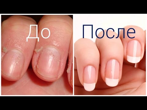 Видео: ✦ Как сделать чтобы кутикула не росла - ЛАЙФХАК