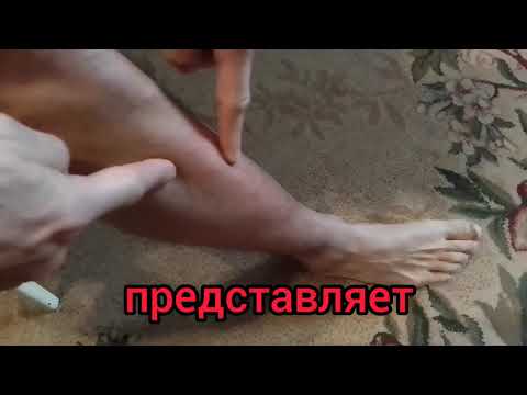 Видео: Восстановление большеберцовой мышцы! Советы от #БегонутыйМассажист