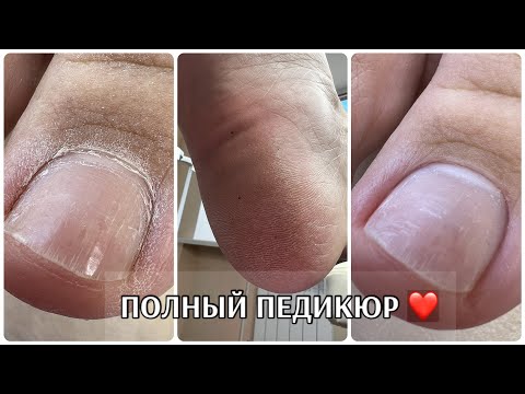 Видео: ПОЛНЫЙ педикюр без покрытия🤘🏻 SMART обработка стоп❤️ чудо спасение🙉 работа БЕЗ ПЫЛИ🔥
