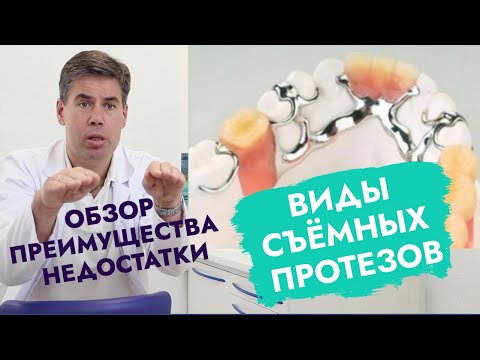 Видео: Виды съёмных протезов.