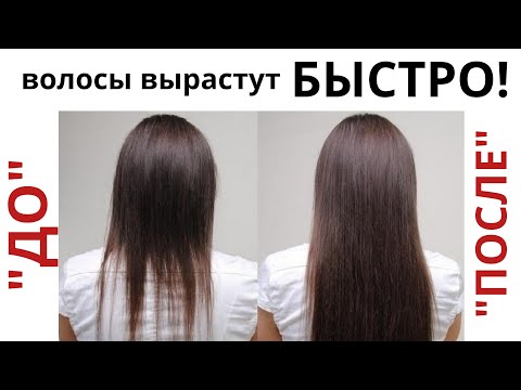 Видео: КАК БЫСТРО ОТРАСТИТЬ ДЛИННЫЕ ВОЛОСЫ!  Сильное средство для роста волос!  Касторовое масло для волос