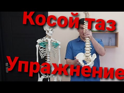 Видео: Упражнение для исправления перекоса таза. Как исправить с помощью ходьбы.