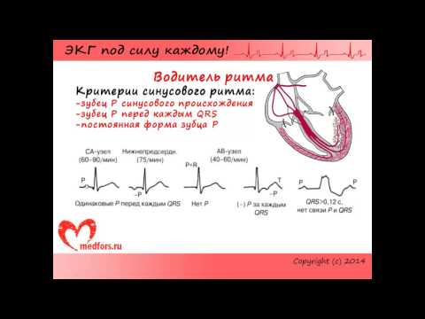 Видео: Урок 3. Видеокурс "ЭКГ под силу каждому".