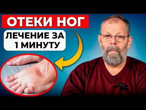 Видео: 1 упражнение поможет за 1 минуту при отёках!