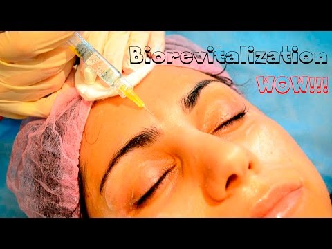Видео: Биоревитализация пошагово // Как сохранить молодость кожи? // Beauty with Dianatadi