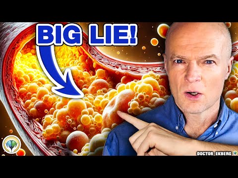 Видео: #1 Самая ОПАСНАЯ ложь о холестерине, которую вы должны знать!