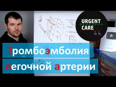 Видео: Все о ТЭЛА - тромбоэмболия легочной артерии