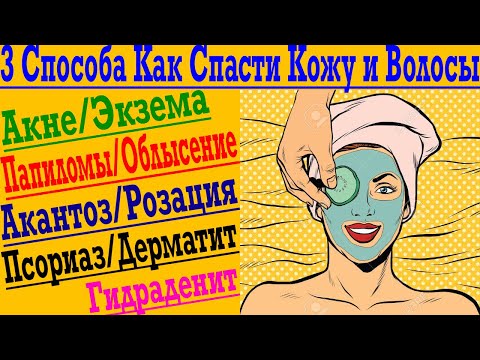 Видео: Спасаем Кожу и Волосы! Акне Экзема Папилломы Облысение Акантоз Розацеа Псориаз Дерматит Гидраденит