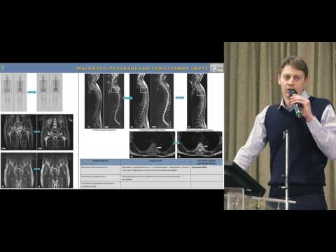 Видео: Особенности оценки лечебного эффекта при метастазах в костях