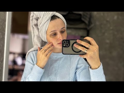 Видео: Мене побила рідна людина, тепер я з синяками 