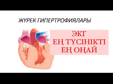 Видео: Экг қазақша 3-сабақ. Жүрек гипертрофиялары. Түсінікті медицина каналы