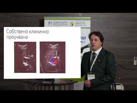 Видео: 46. Клинична характеристика и предоперативно поведение при тромбоза на екстрахепаталната част ...