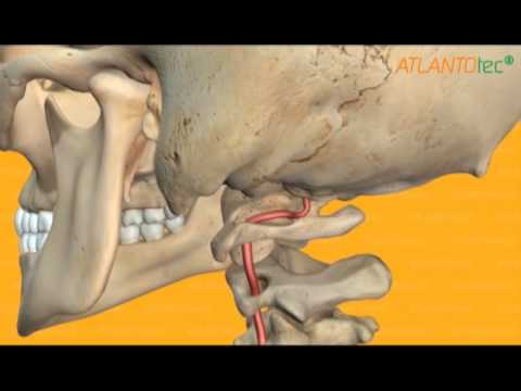 Видео: ЕЛАТОМ. Вертебролог