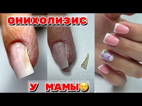 Видео: ОНИХОЛИЗИС на ногтях 😐 ФРЕНЧ опаловыми гелями 💅 Маникюр