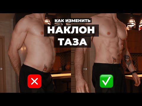 Видео: Фиксация переднего наклона таза (ПОЛНАЯ ПРОЦЕДУРА)