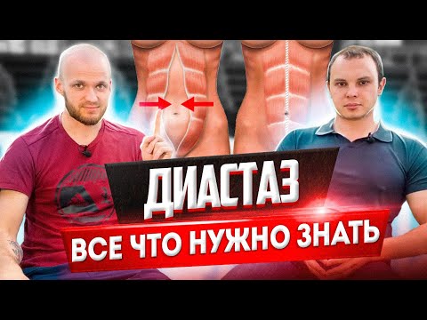 Видео: Упражнения при диастазе, тренер и врач! Как укрепить поперечную мышцу живота. Все что нужно знать!